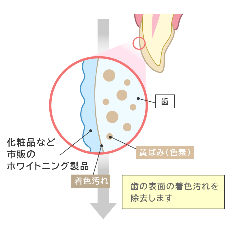 サロンなどでのホワイトニングの仕組み図