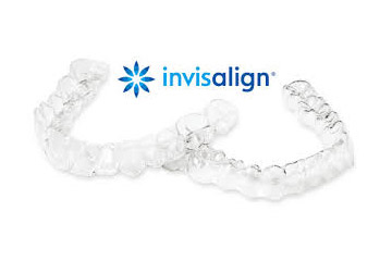 インビザライン