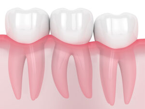 親知らずイメージ